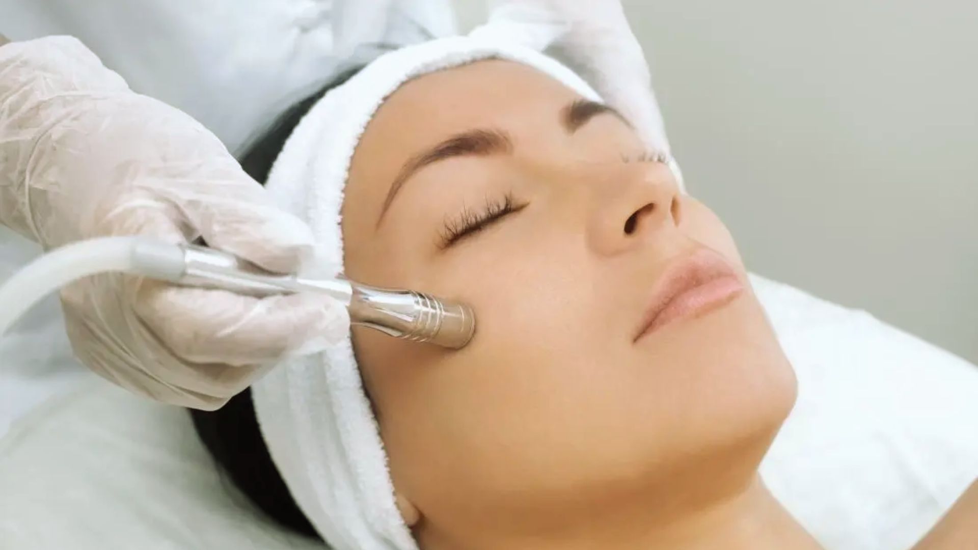Microdermabrasion