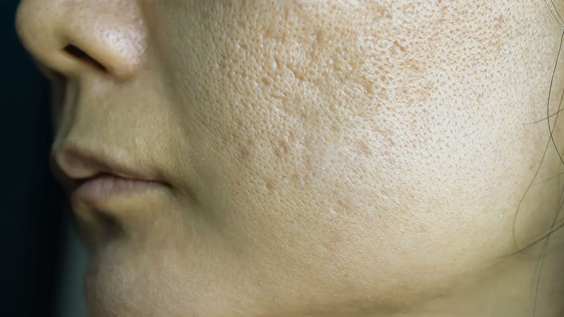 Why Pores Look Bigger