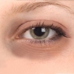 dark-circles-under-eyes