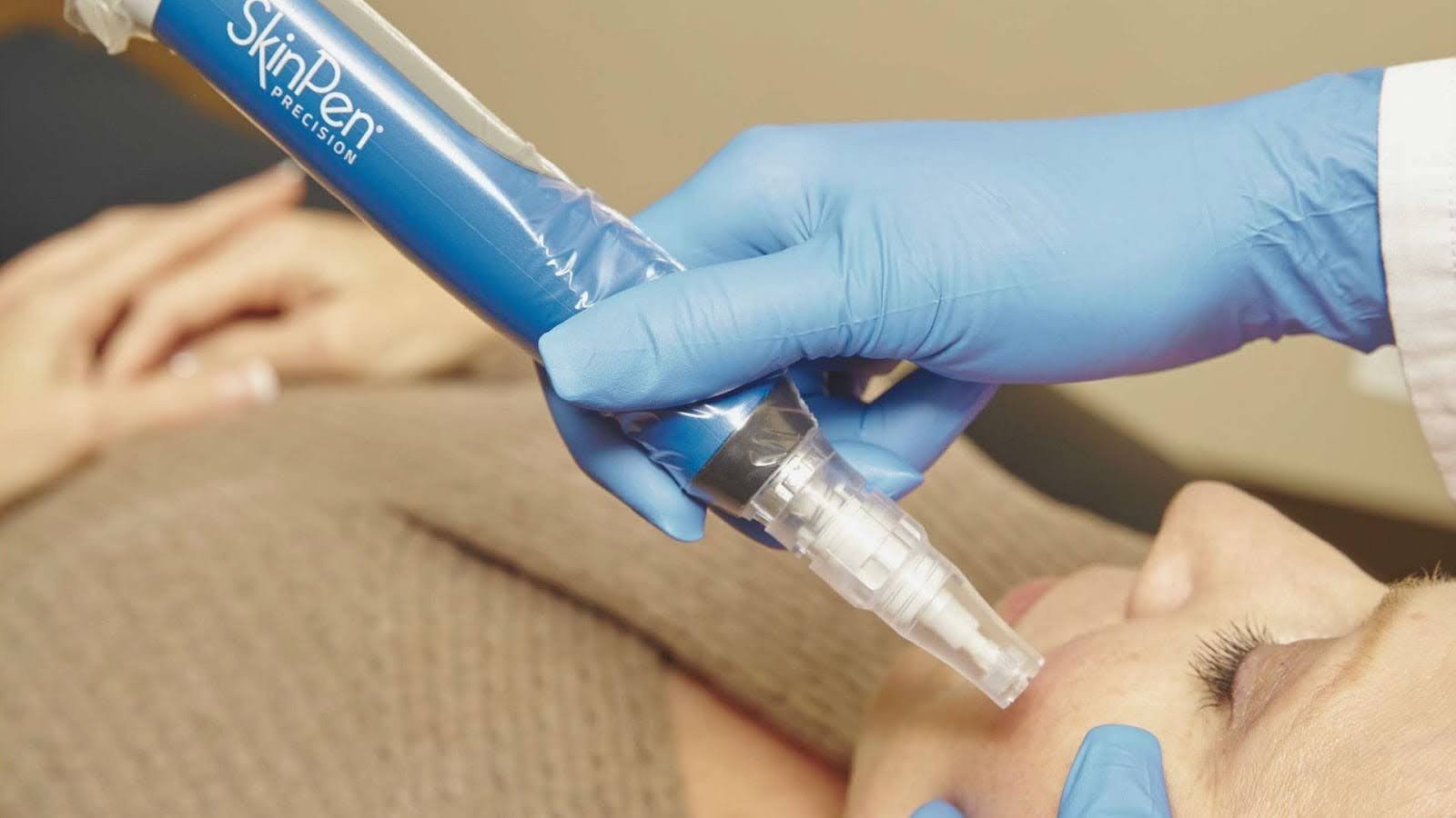 Advantages Over Other Treatments