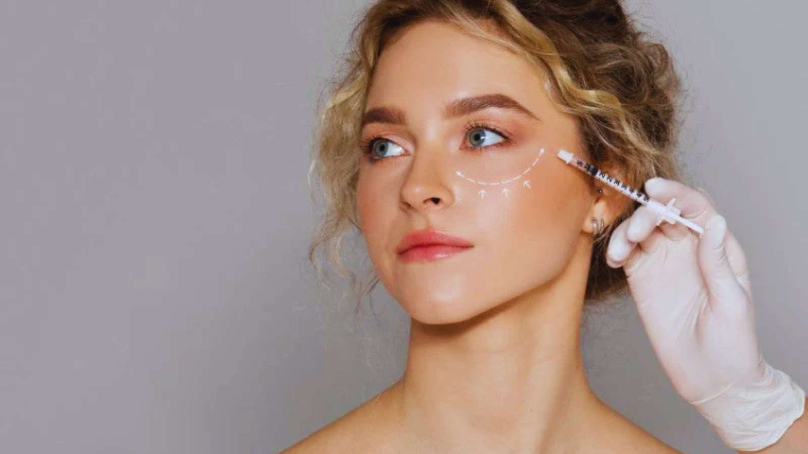 Tear Trough Mesotherapy