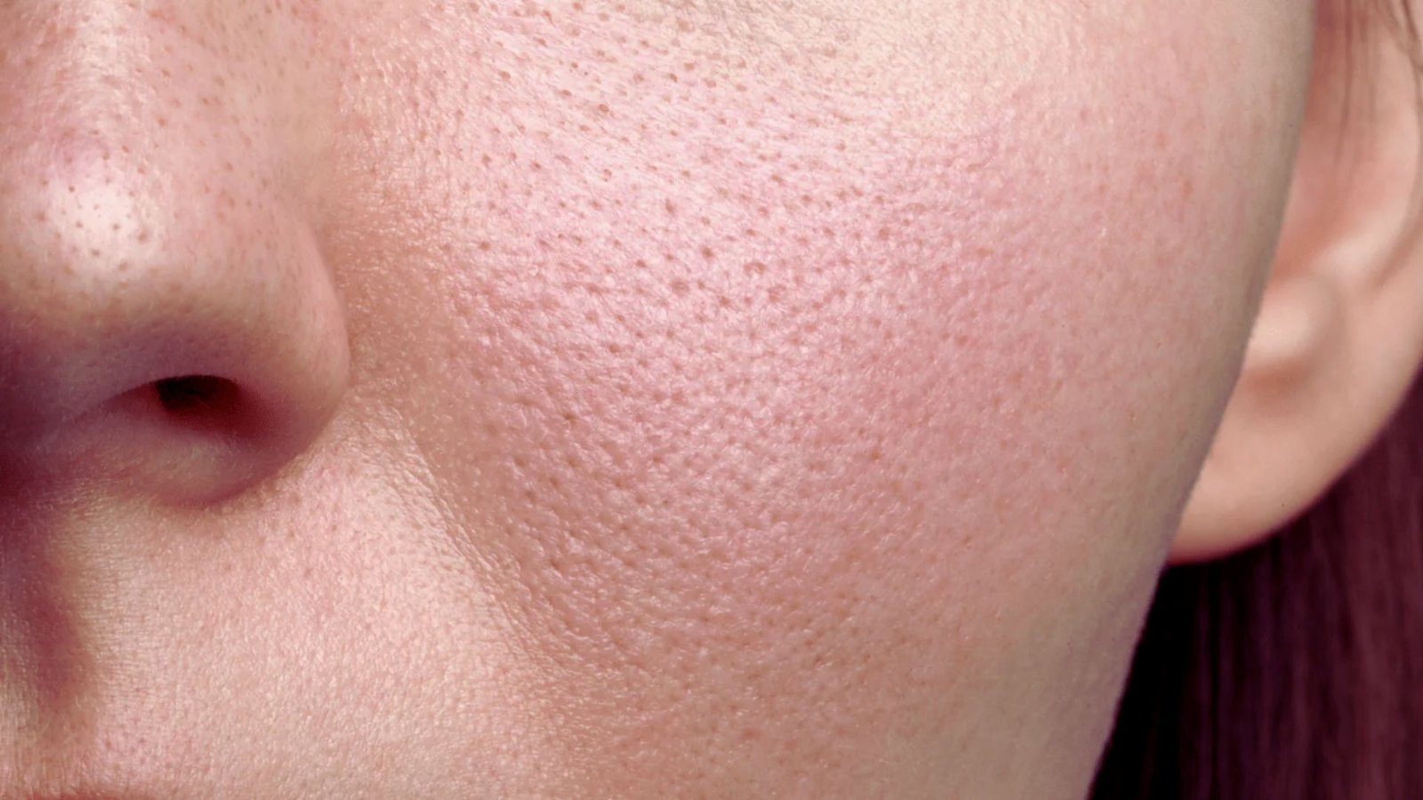 Causes of Grainy Skin Texture on Face