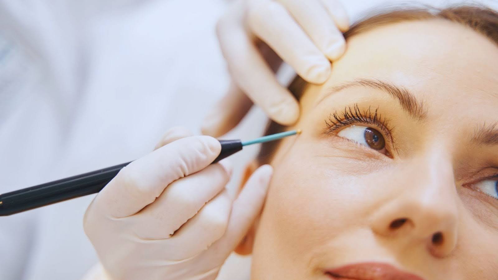 Does Getting a Mole Removed Hurt