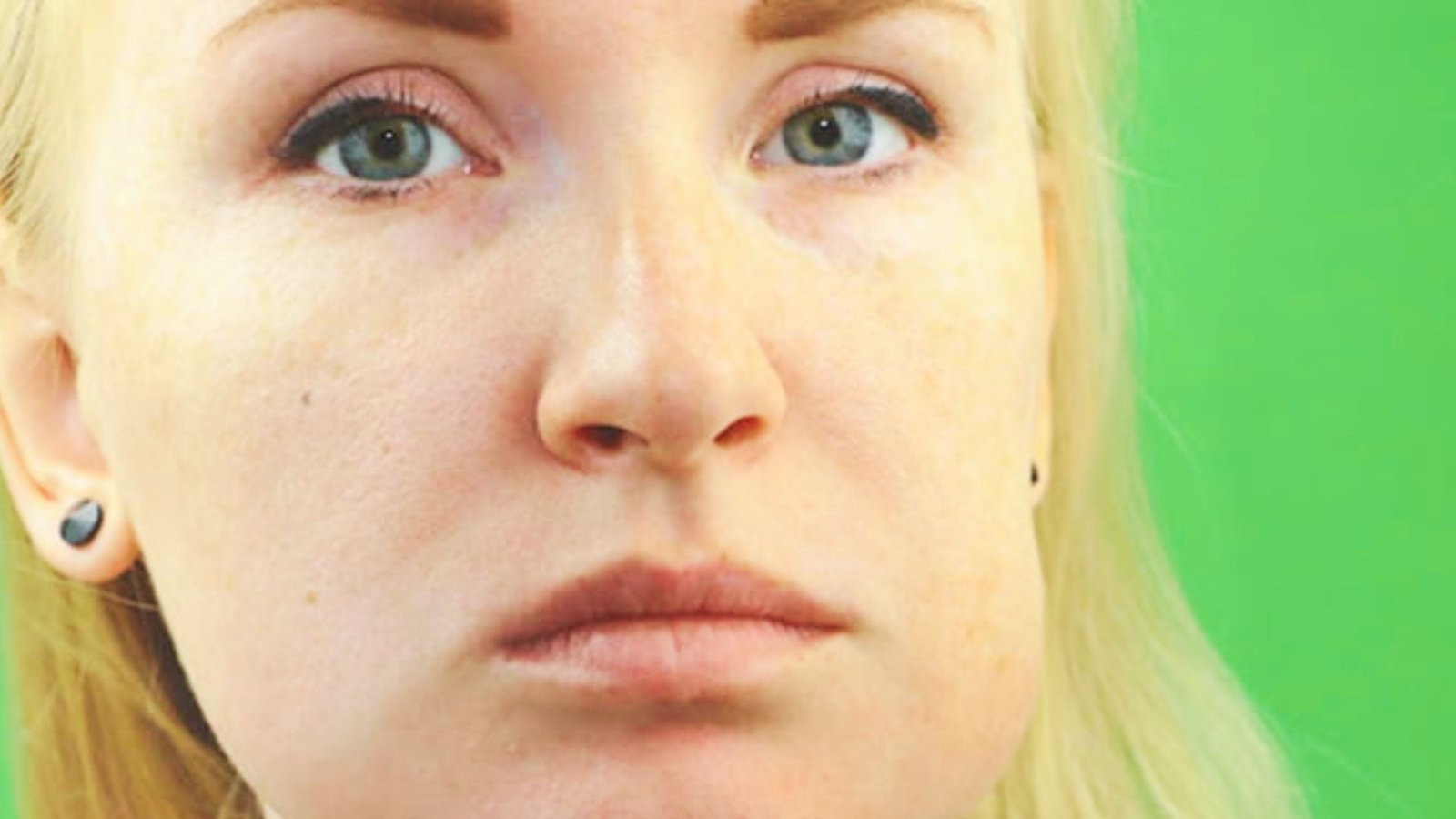 Infection and Severe Swelling