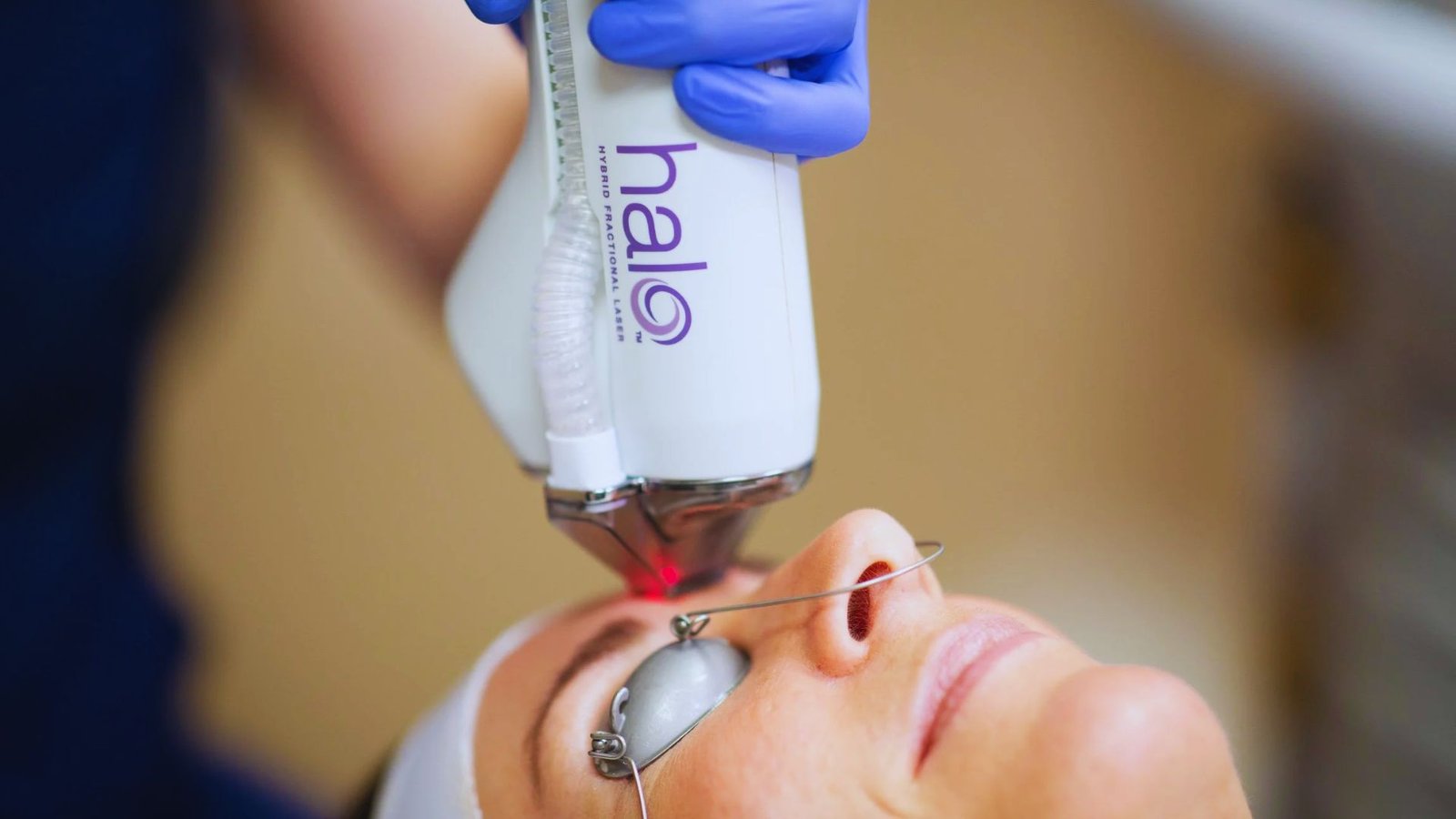 Halo Laser Treatment