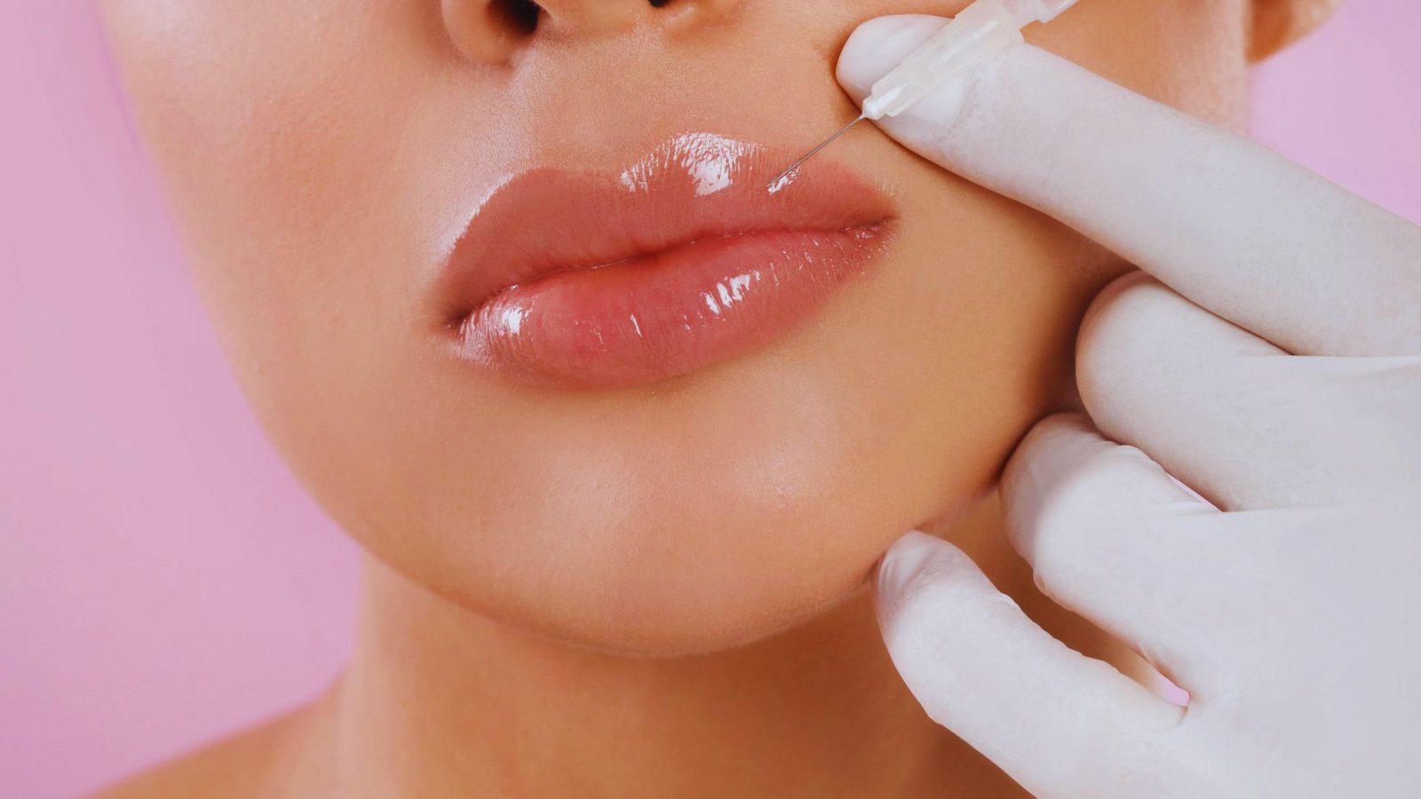 How Lip Fillers Work