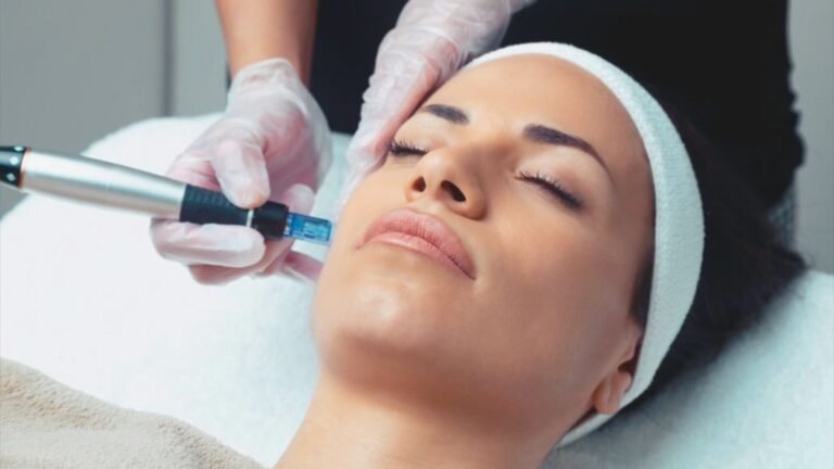 Microneedling with Exosomes