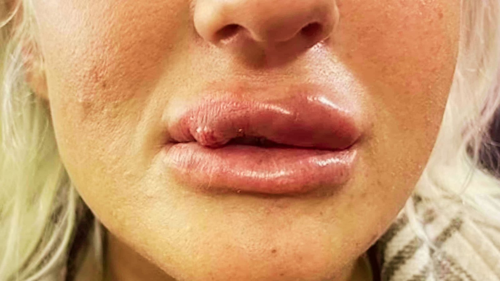 Lumps, Nodules, and Granulomas