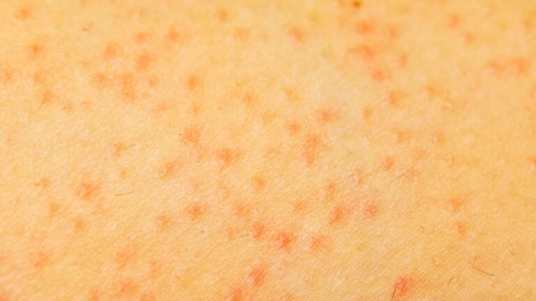 Red Bumps After Waxing