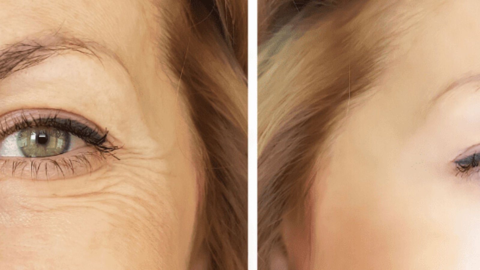 Reduce Fine Lines and Wrinkles