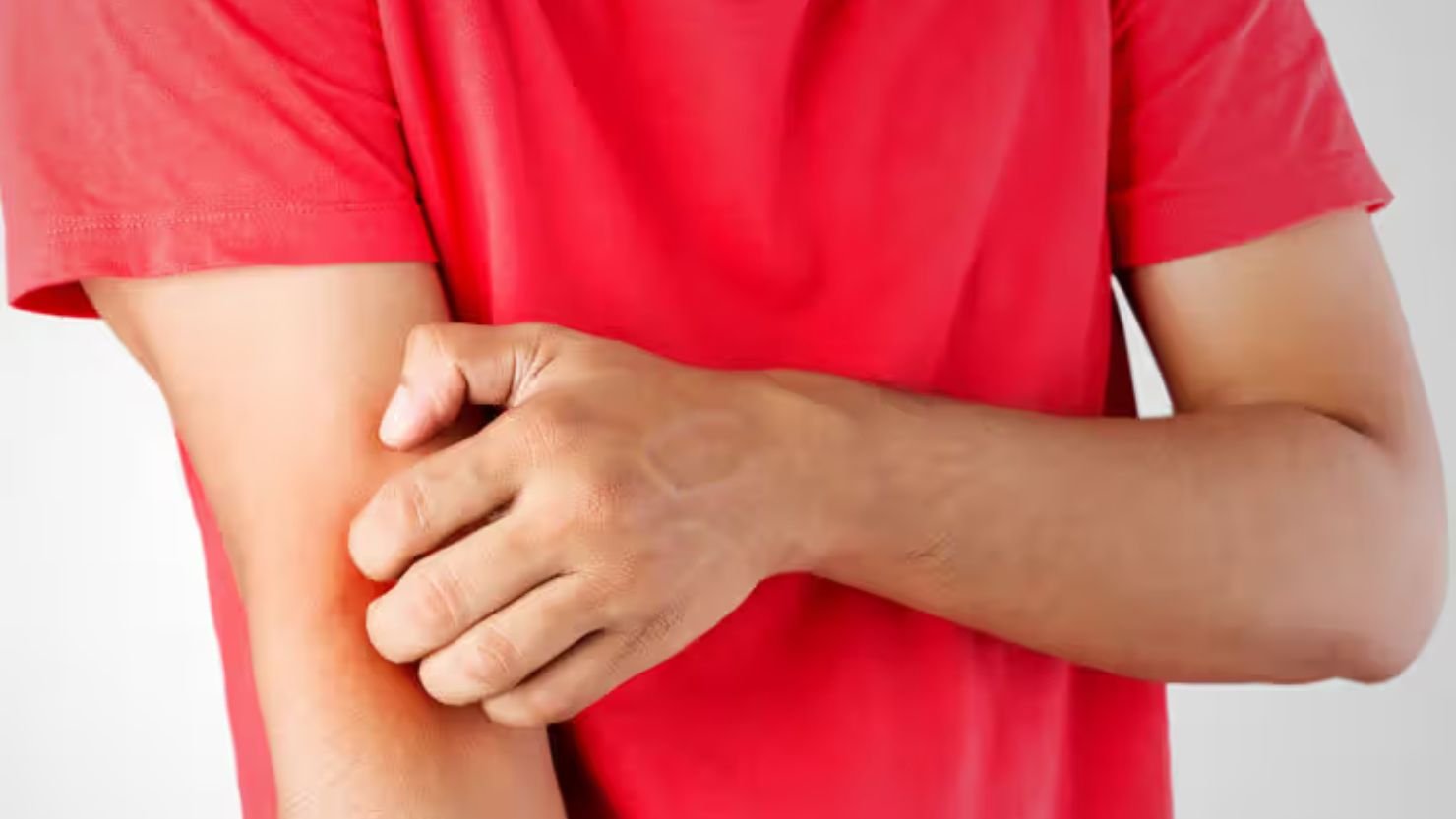 Bacterial and Fungal Infections