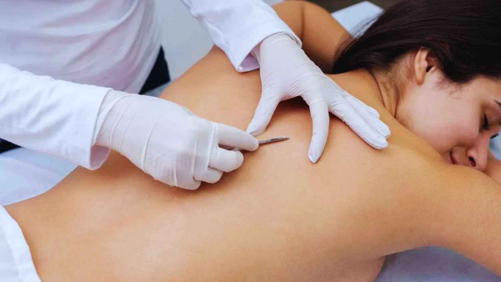 Back Facial Benefits