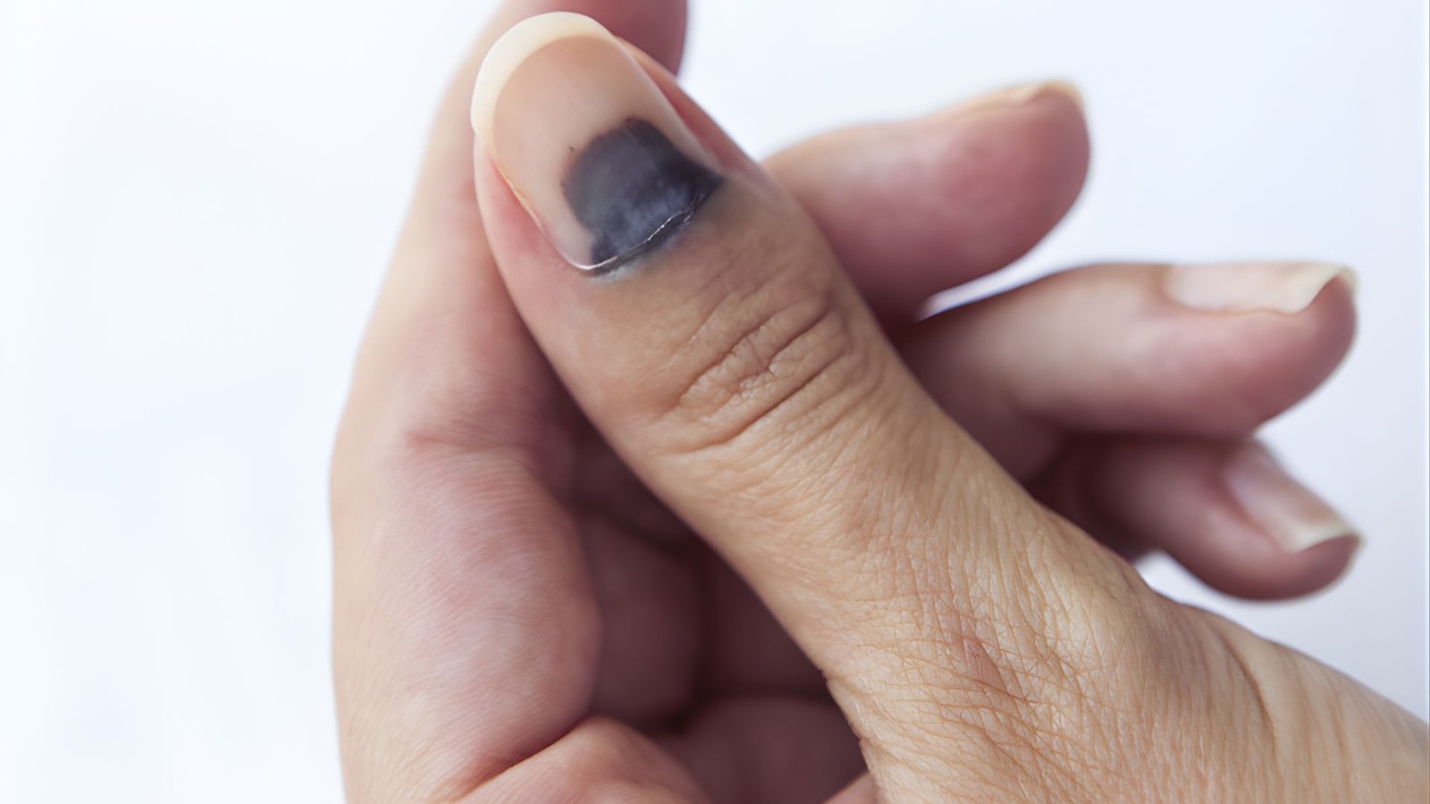 Everyday Trauma You May Not Remember