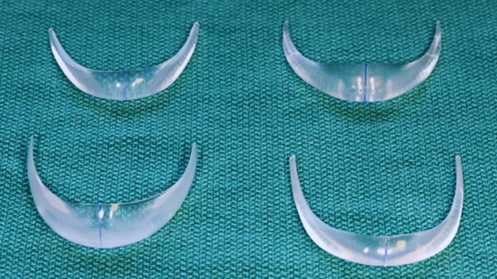 Chin Implant Types by Size