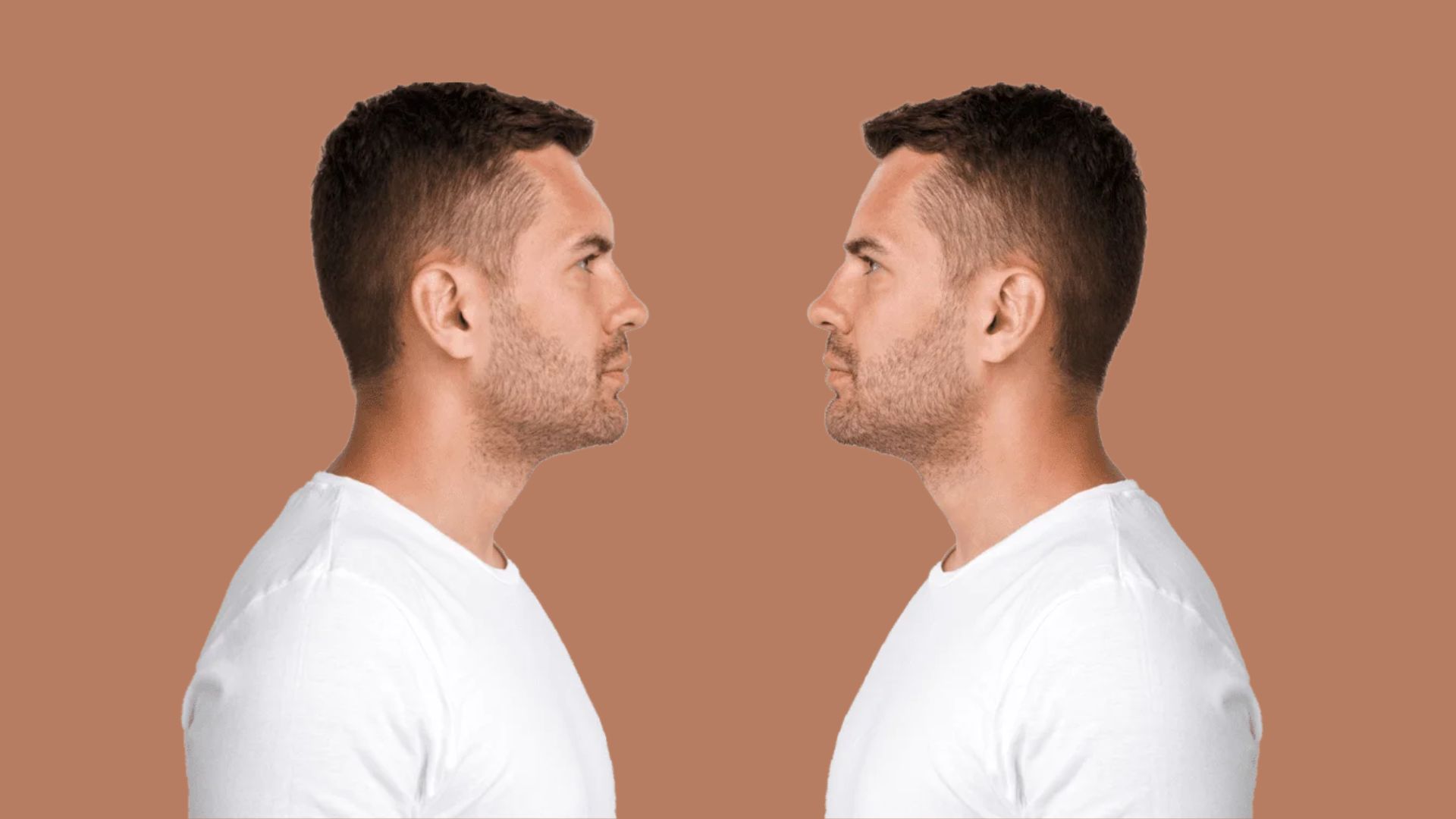 What Is Brow Bone Reduction