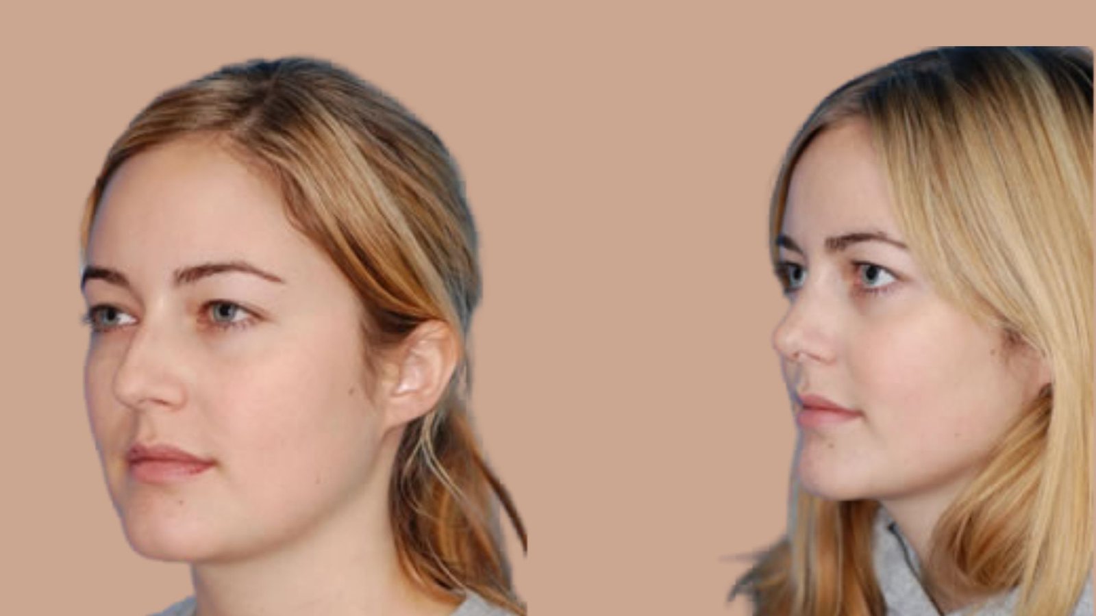 The Septoplasty Procedure