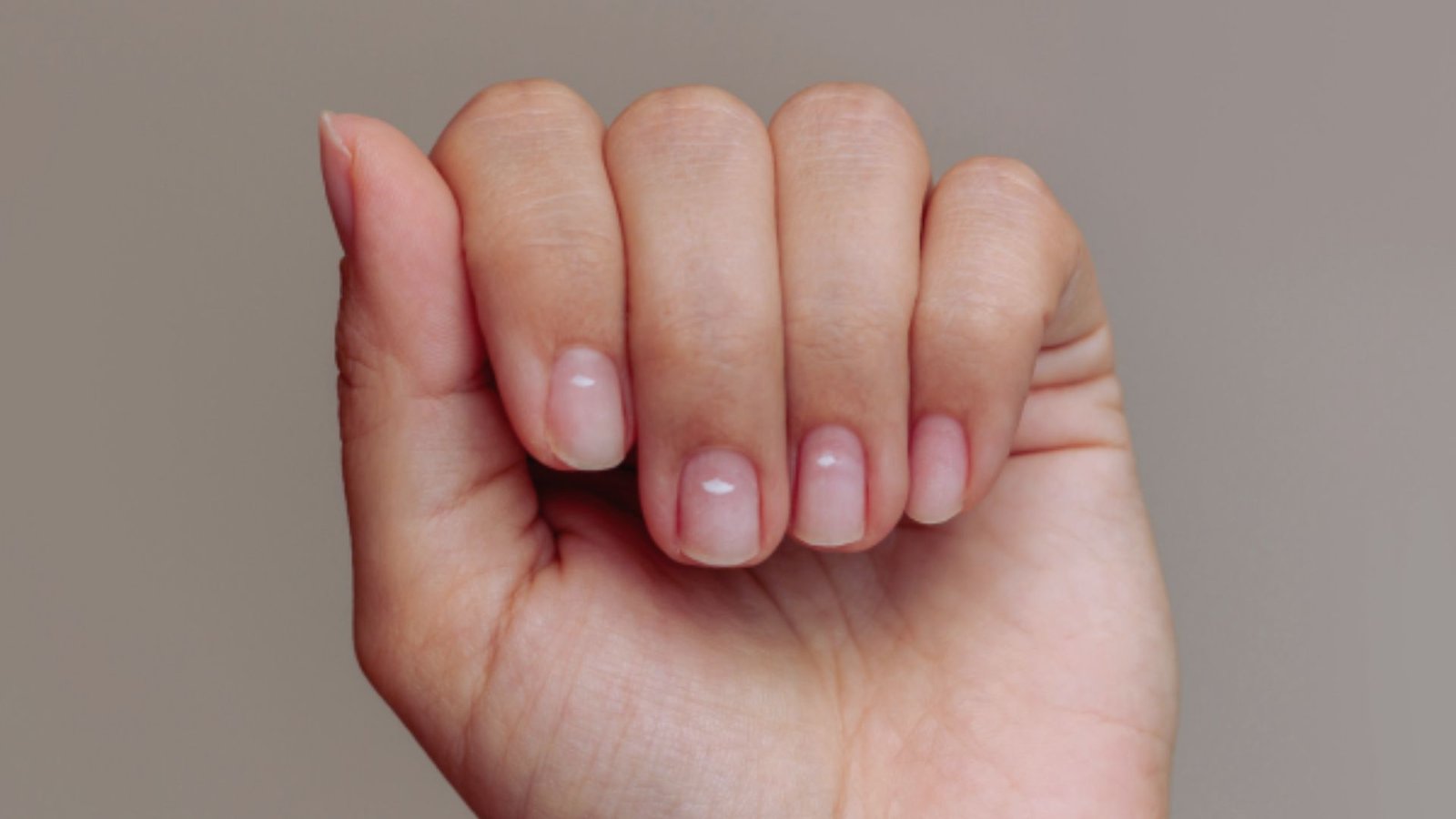 When Should You Be Concerned About White Spots