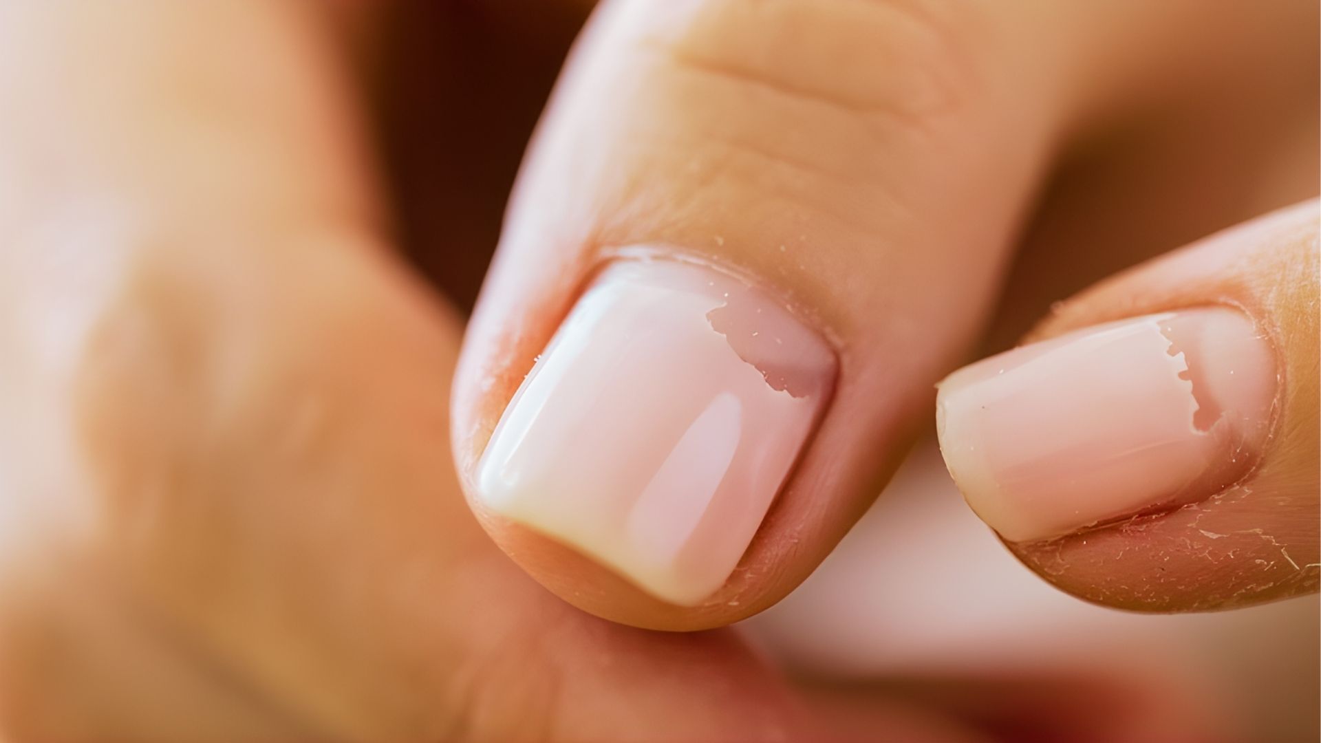 Nails Lifting From Nail Bed After Gel Nails