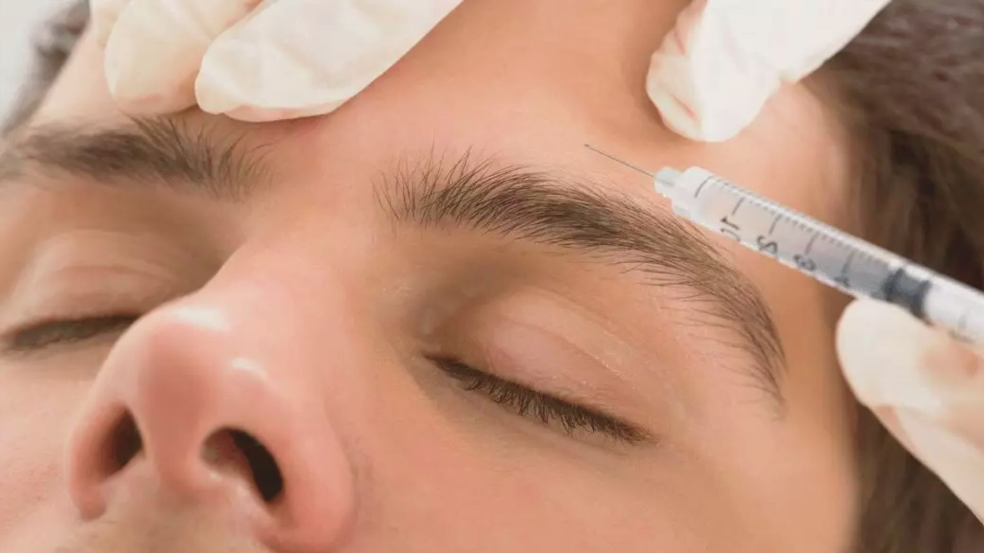 How Botox Works for Migraines