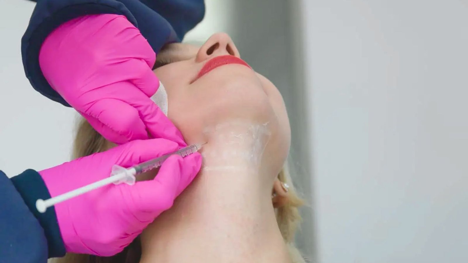 Kybella Injections