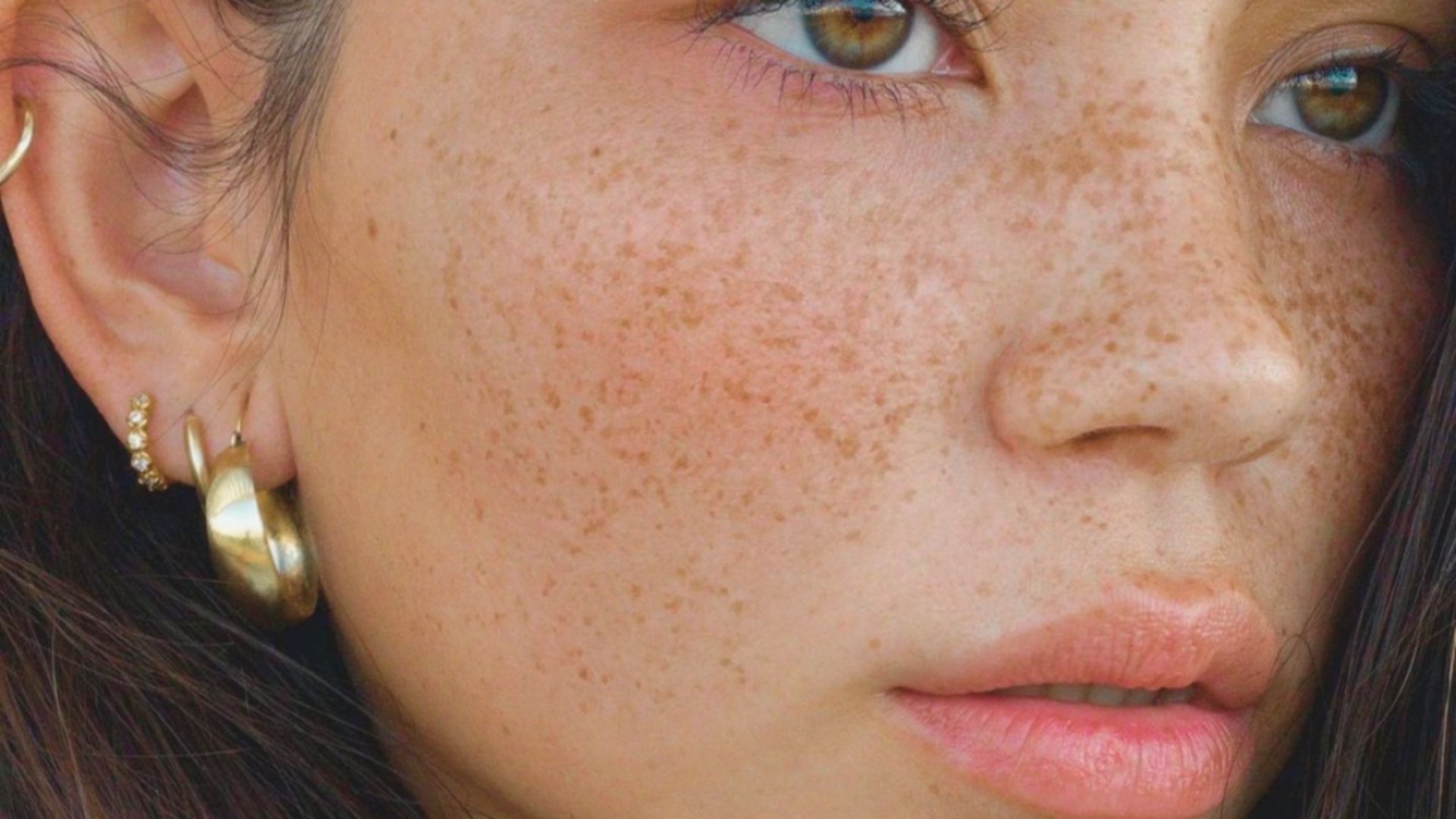 Preventing New Freckles
