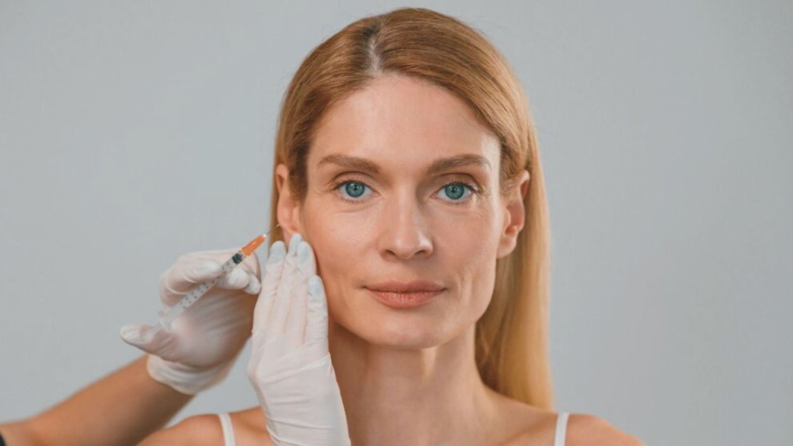 Combining Sculptra and Fillers
