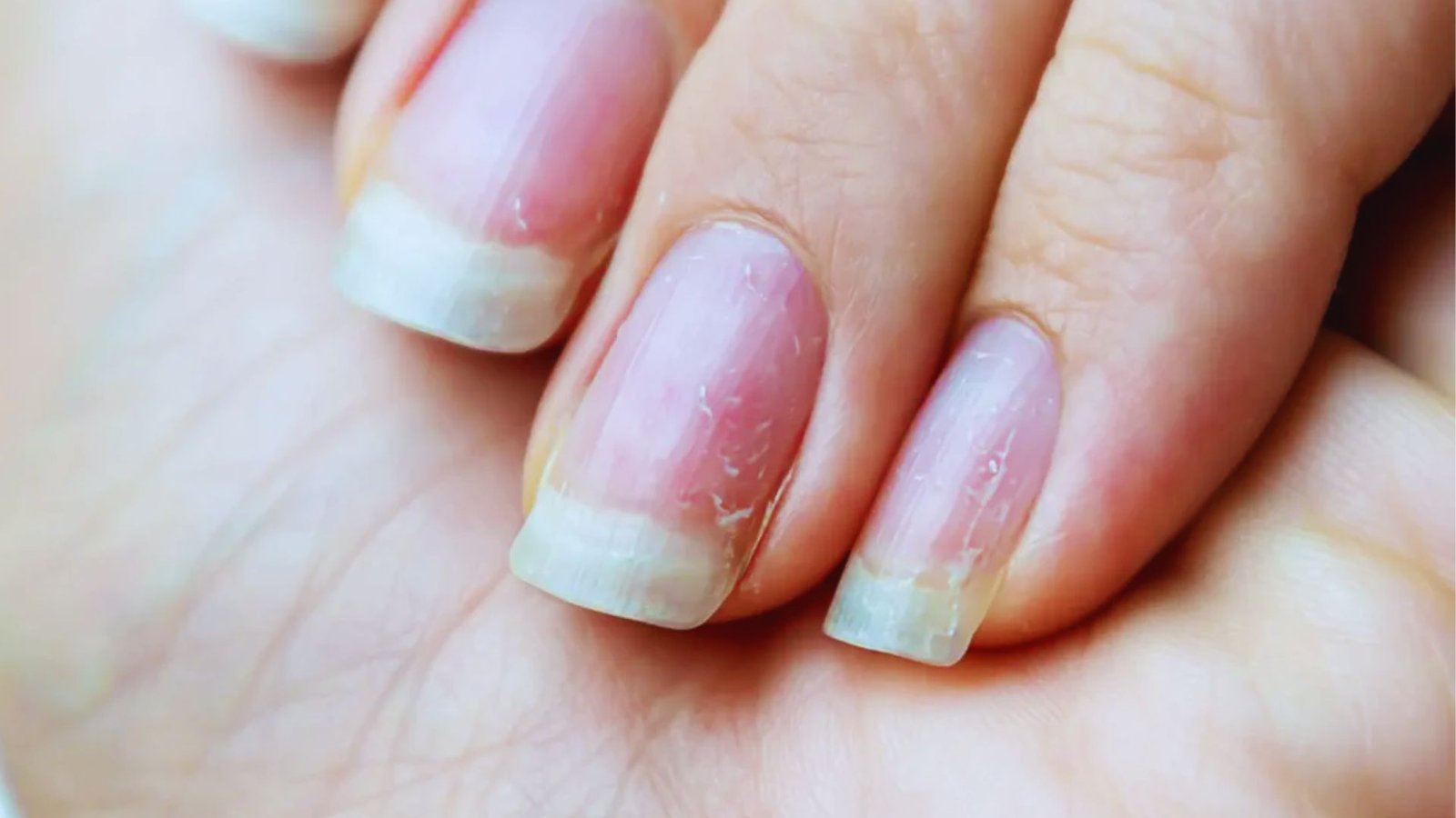 How to Minimise Damage to Weak Nails