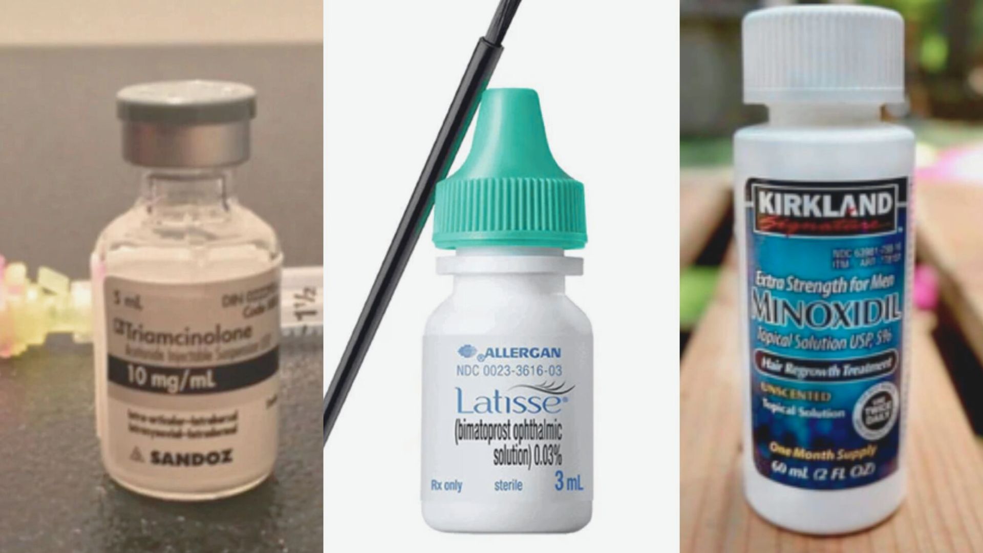 Medical Treatments for Eyelash Loss From Alopecia