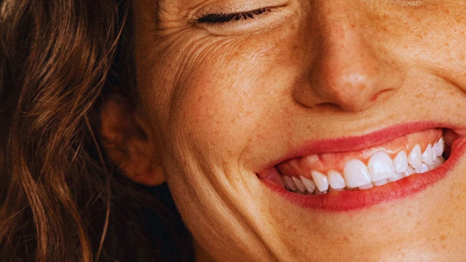 What Are Cheek Fillers