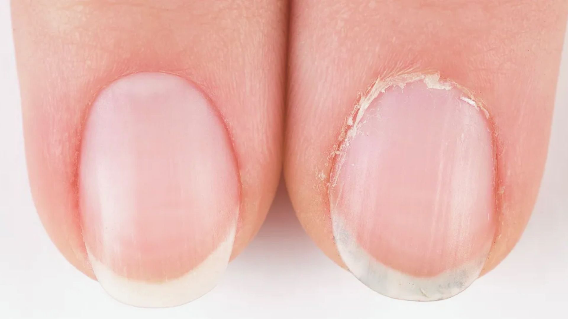 Signs of Healthy vs. Unhealthy Cuticles