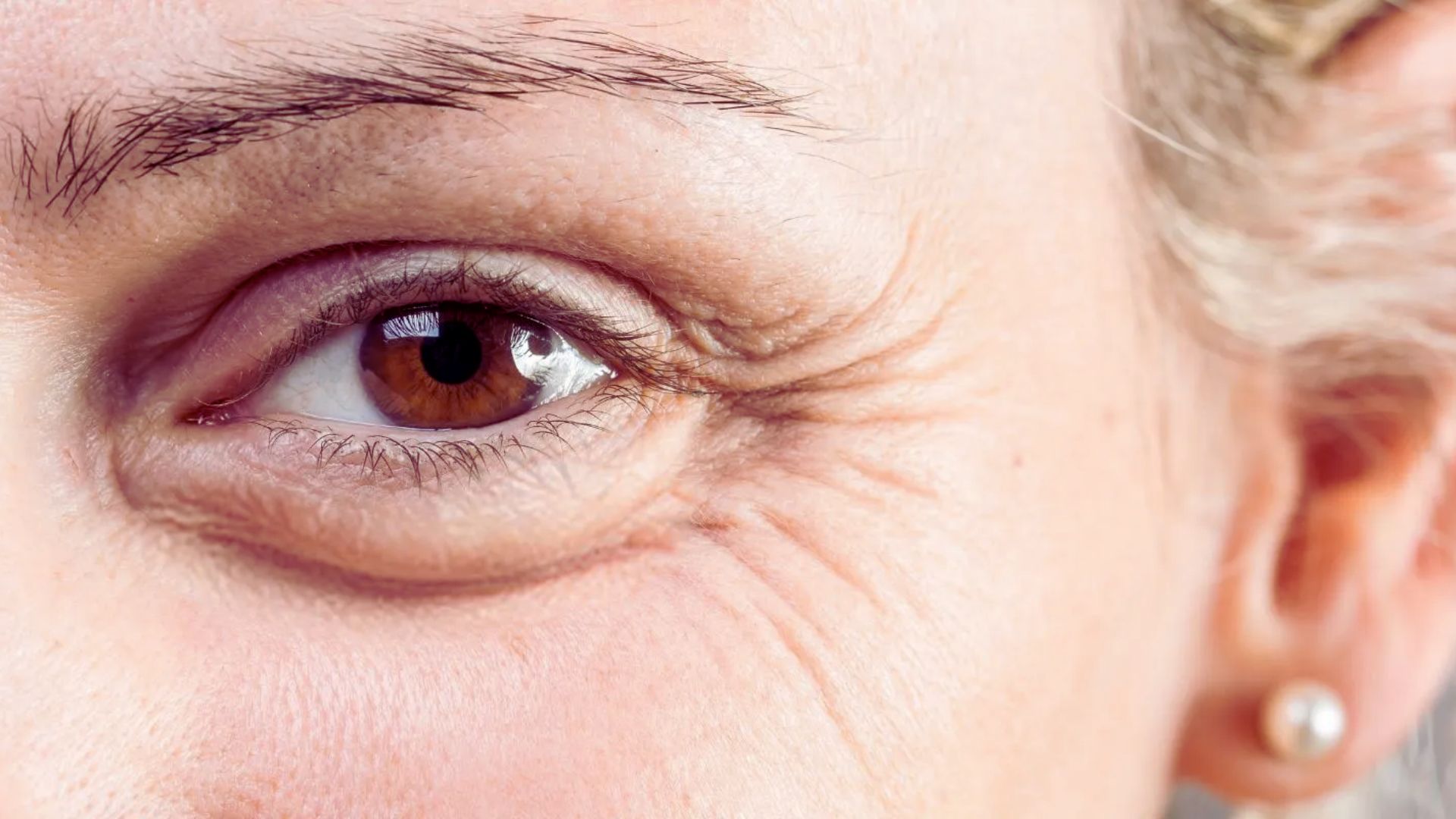 A close-up of a woman's eye showing fine wrinkles and age lines around the eyelid and brow area.