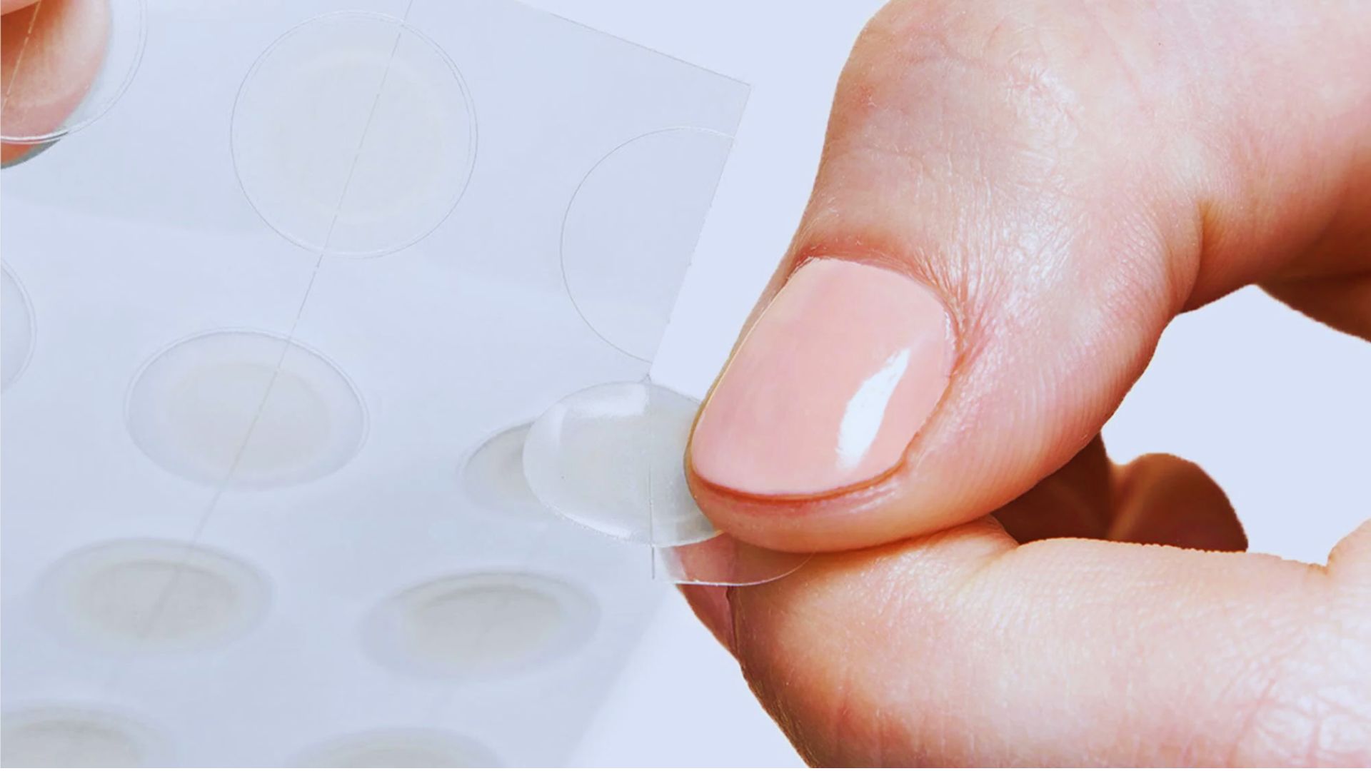 When You Can Use a Pimple Patch