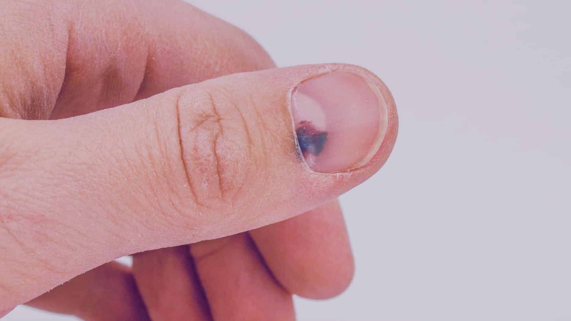 Physical Trauma and Injuries