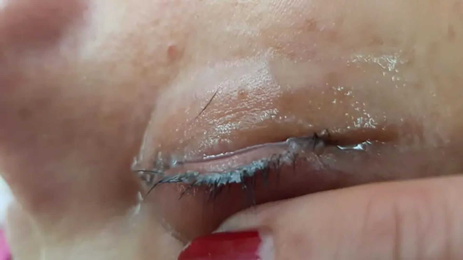 A close-up of a woman's face featuring a prominent white patch over her eye, highlighting her unique appearance