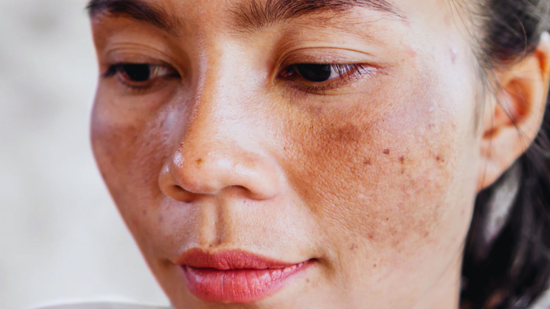 A woman with a freckled face smiles softly, showcasing her natural beauty and unique skin texture.