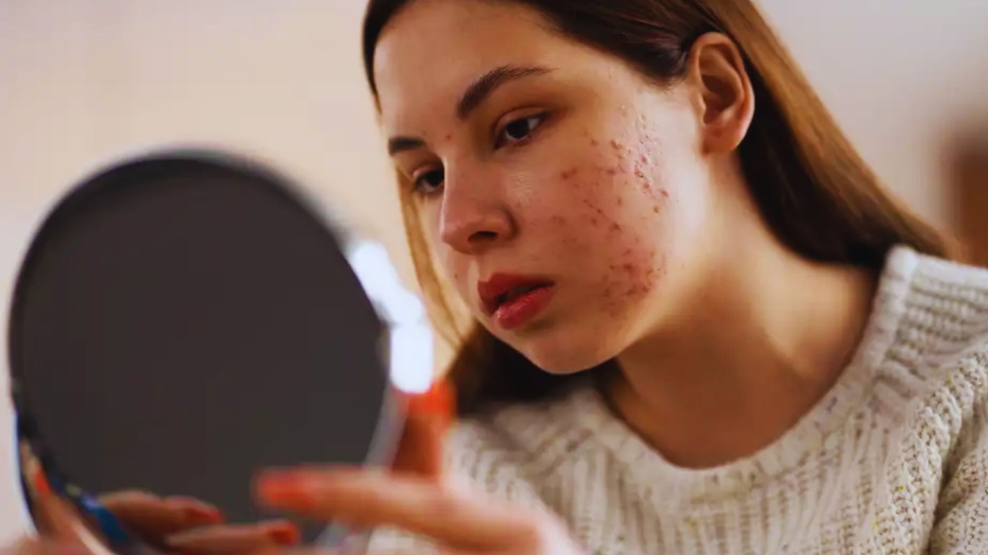 A woman examining her face in a mirror, reflecting on her skin during the Adapalene purging process.