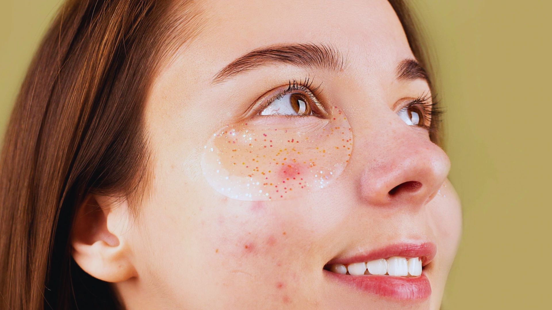 Using Patches on Deep or Broken Pimples