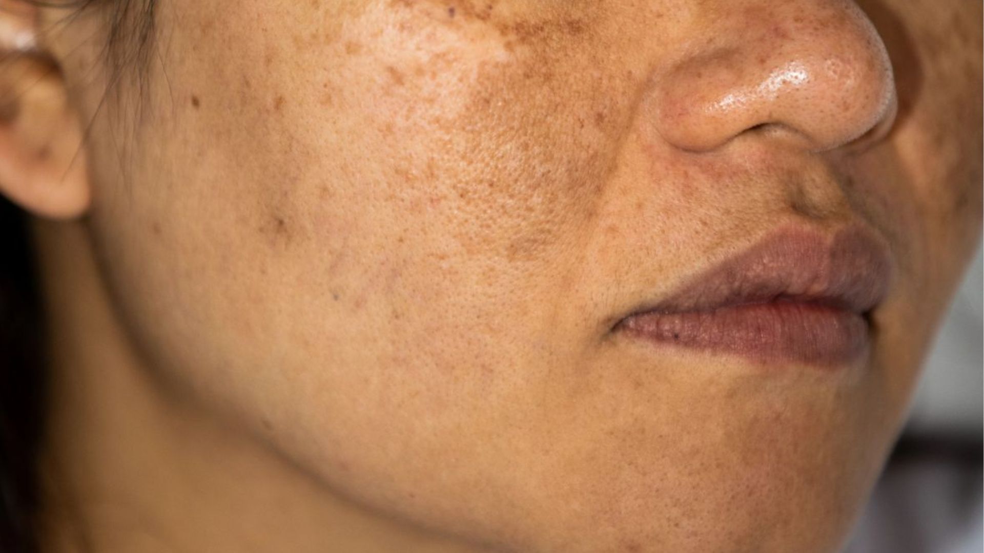 A woman with freckles on her face smiles softly, showcasing her natural beauty and warm expression.