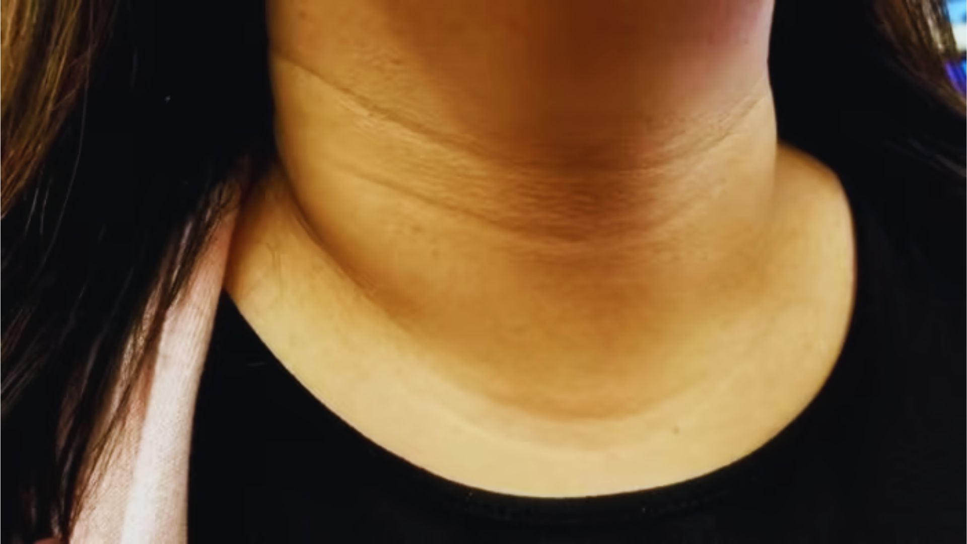 A woman with an exceptionally thin neck, showcasing her physical features.