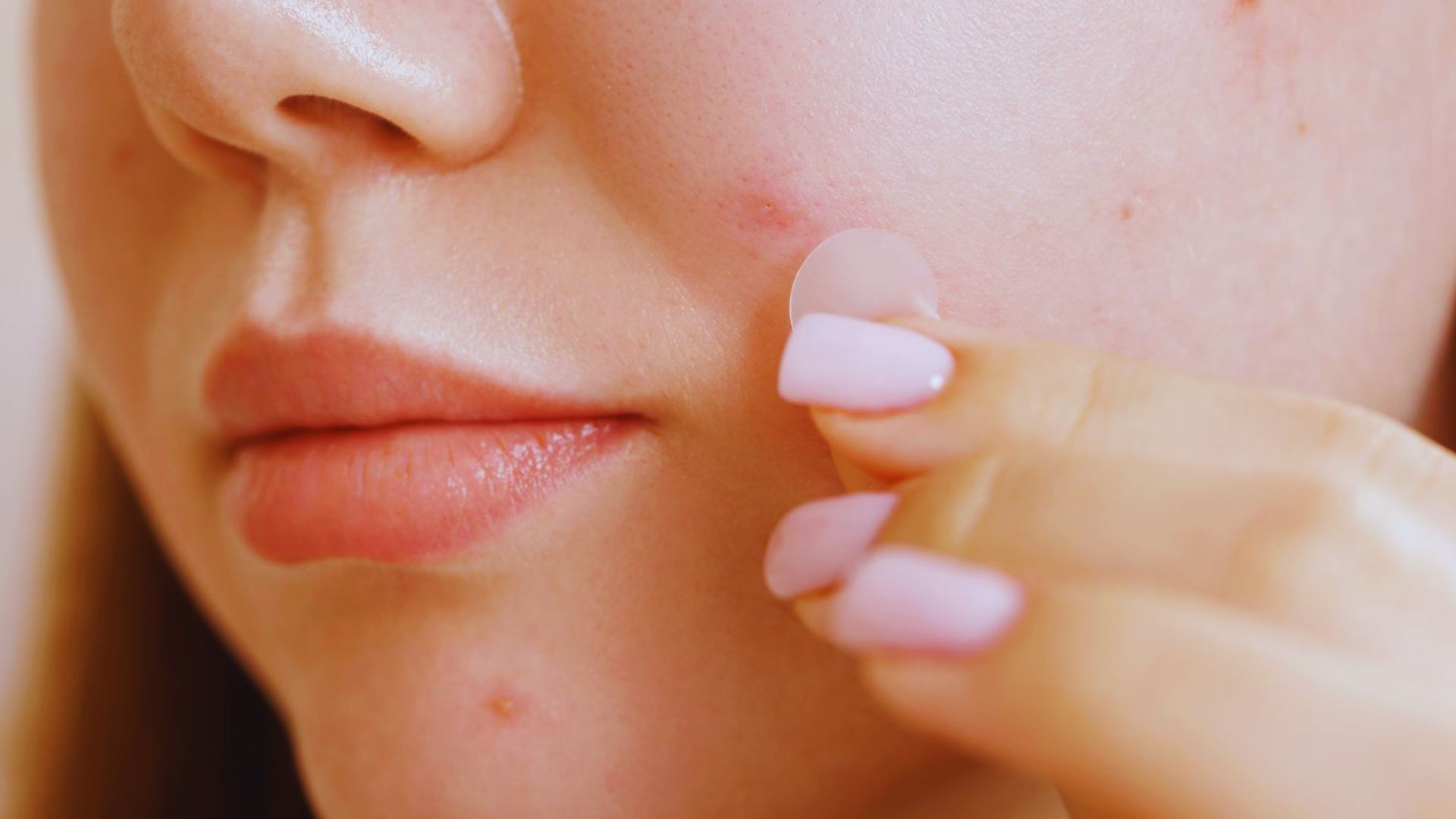 How to Use a Pimple Patch