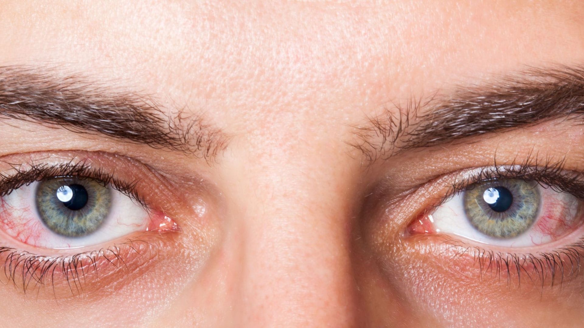 Close-up of a man's eyes, featuring striking red irises that create an intense and captivating gaze.