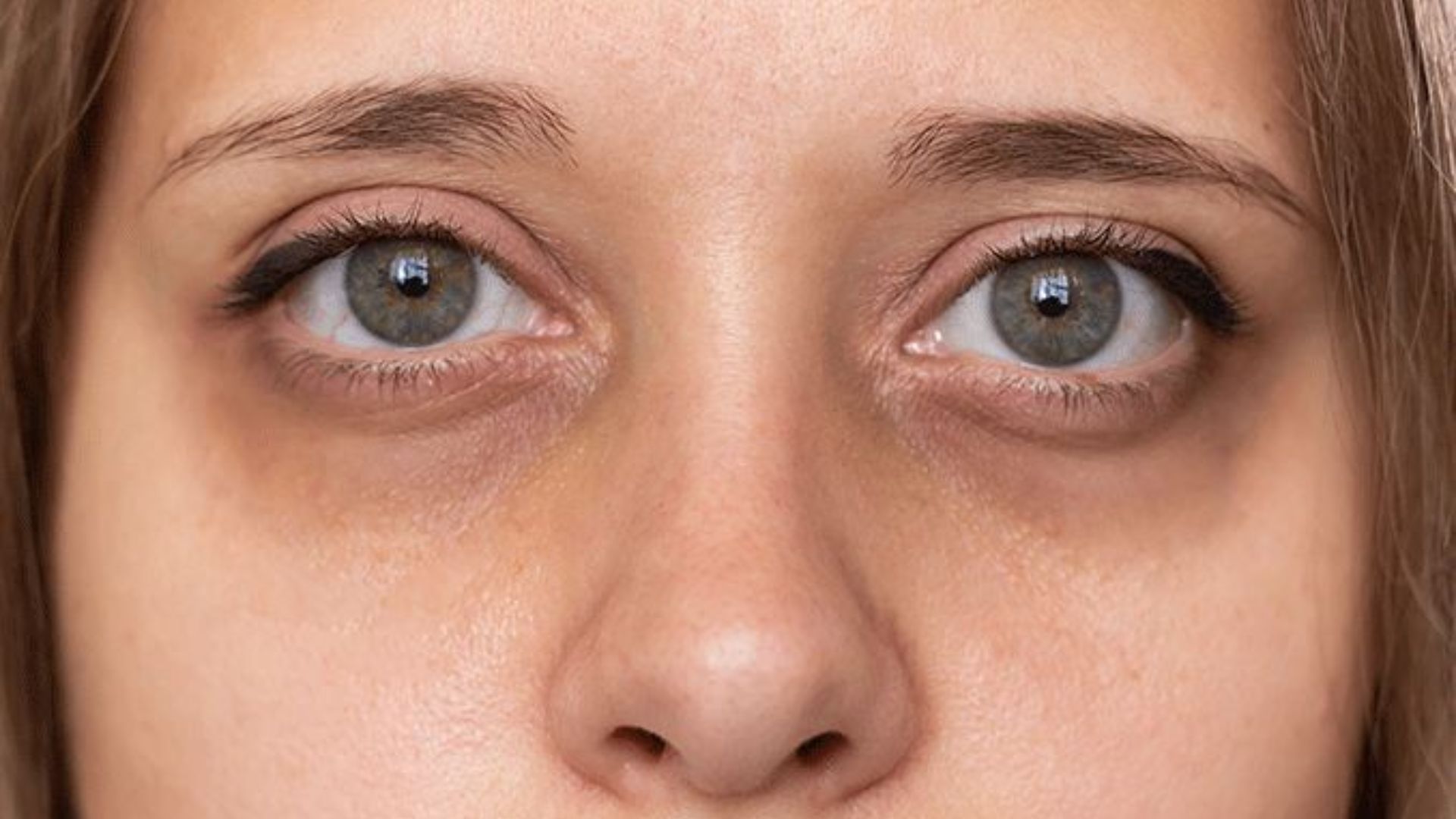 . Close-up view of a woman's nose, highlighting its shape and texture against a blurred background.