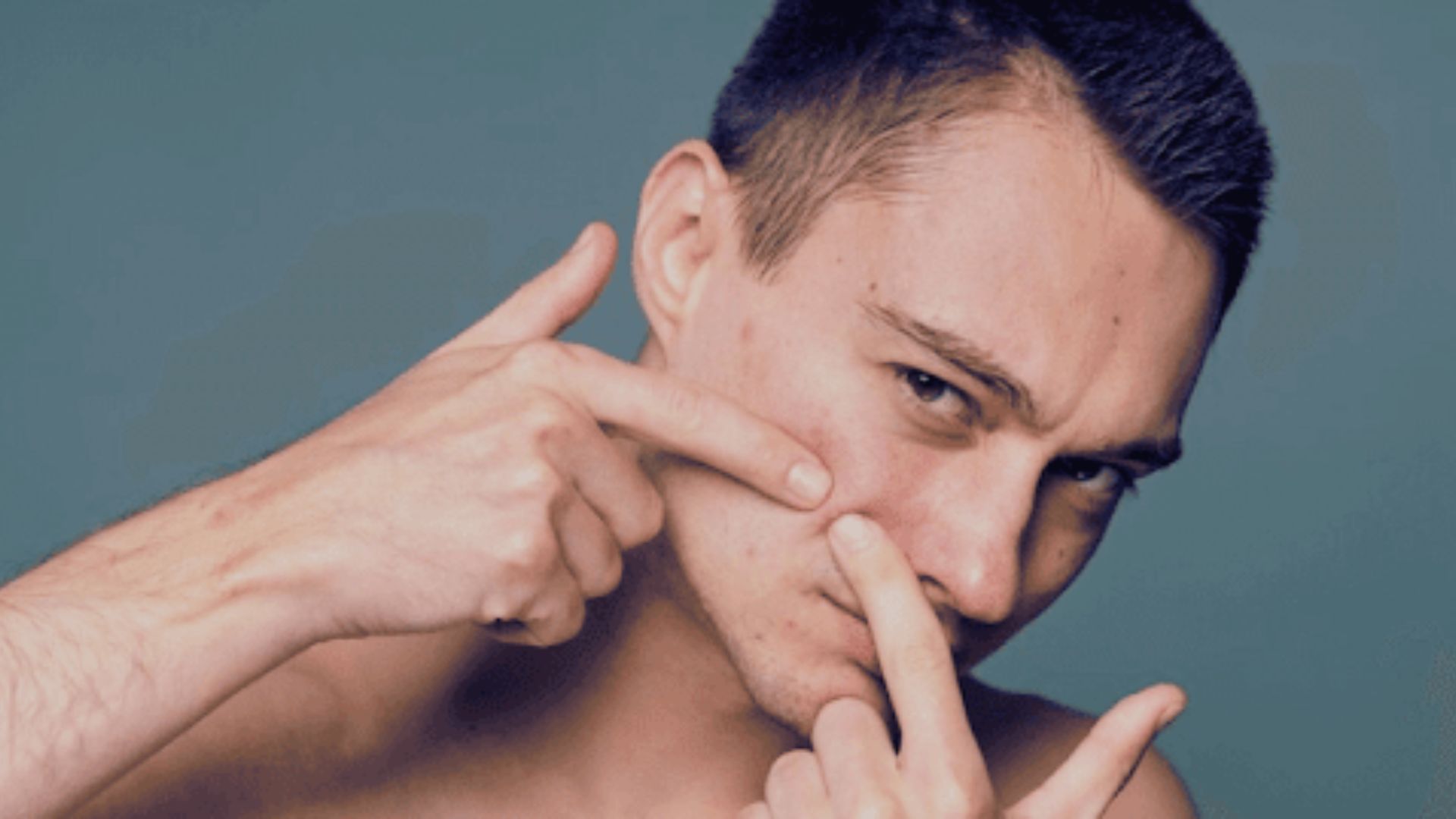 A man touches his nose with his finger, pondering the effects of creatine on acne.