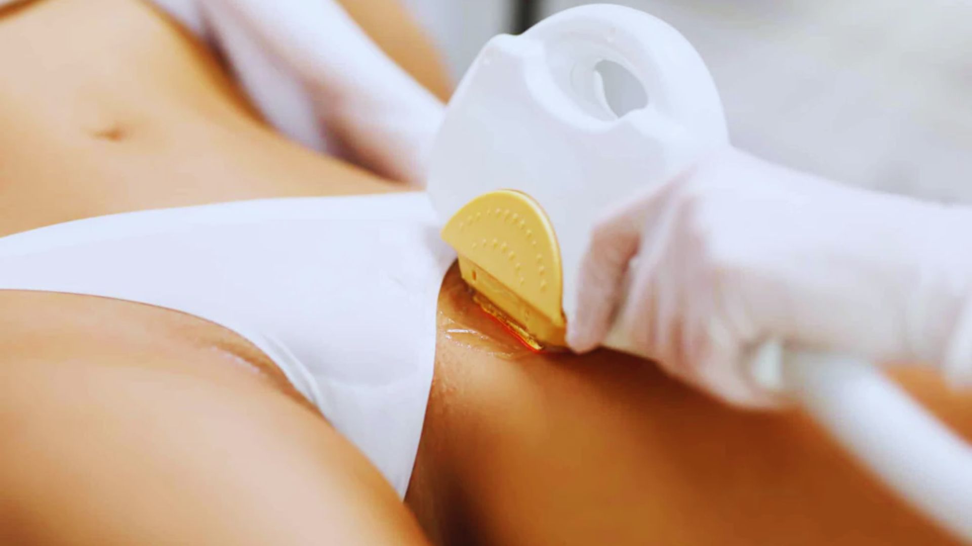 Better Options for Treating Ingrown Hairs