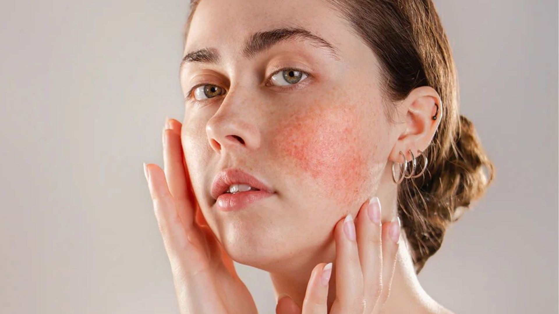 A woman with red skin on her face, displaying a unique skin condition or artistic makeup.