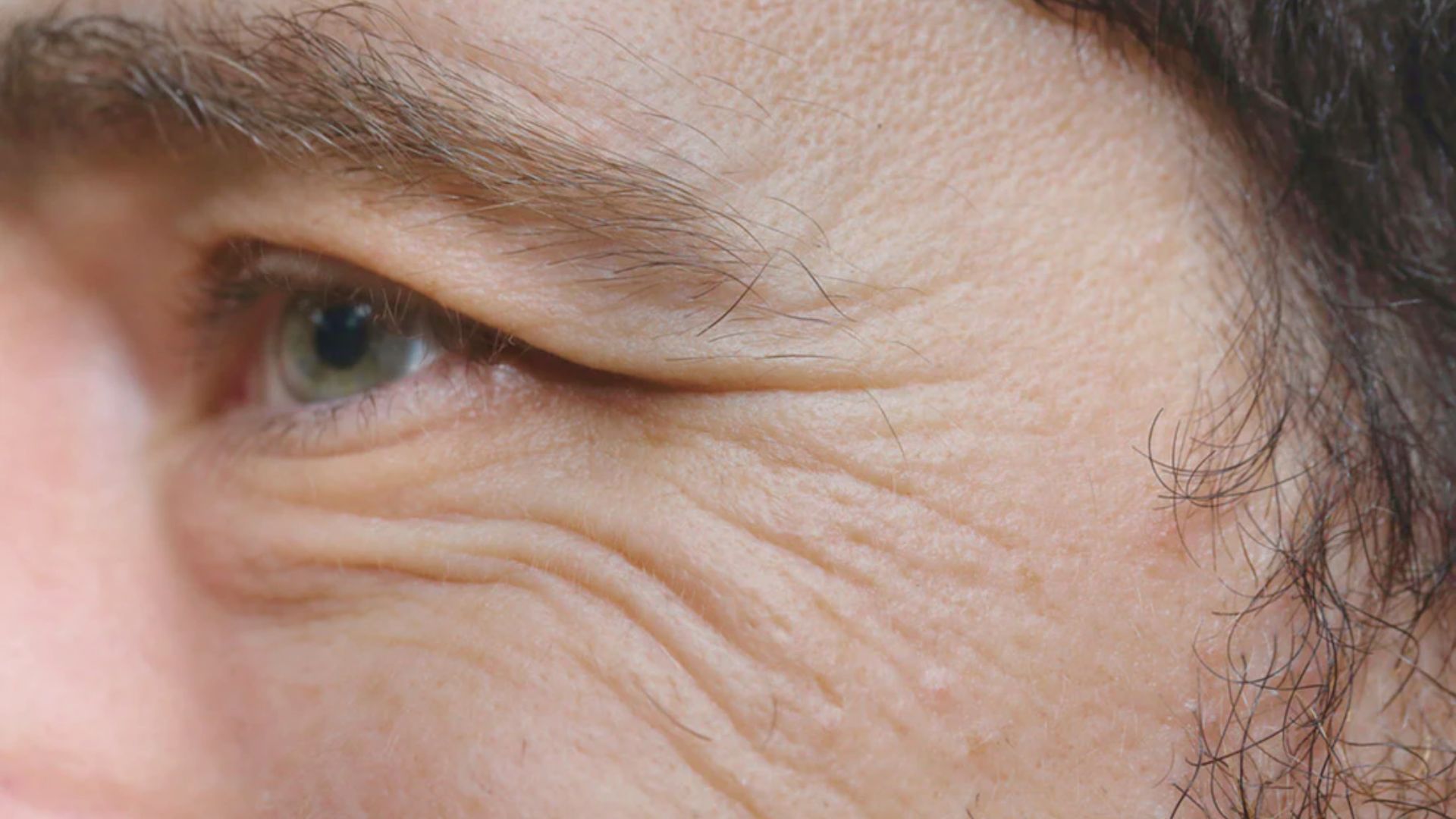Close-up of an older man's face, highlighting deep wrinkles and signs of aging.