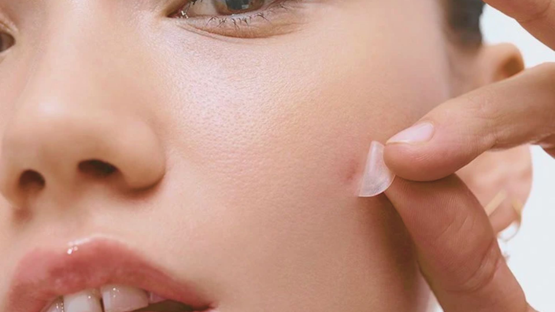 A woman placing a pimple patch on her skin to cover a pimple.