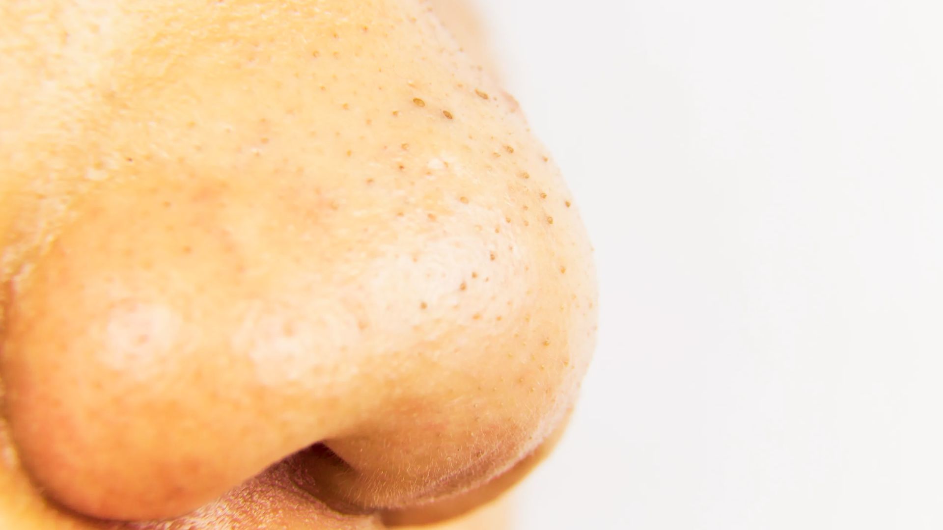 Close-up of a person's nose highlighting a blackhead on the skin's surface.