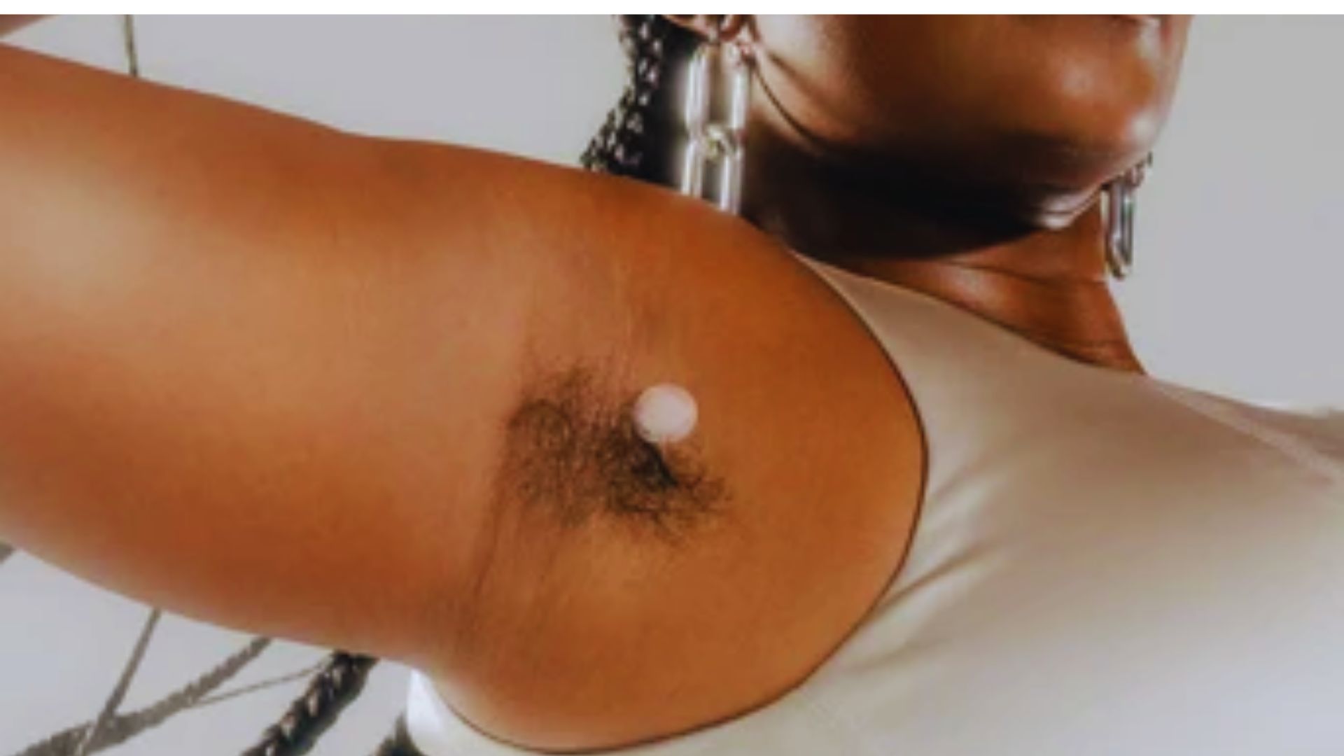 How Pimple Patches Help Ingrown Hairs