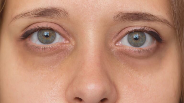 A woman's face in close-up, showcasing her vivid blue eyes and gentle expression.